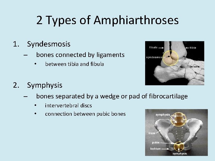 2 Types of Amphiarthroses 1. Syndesmosis – bones connected by ligaments • between tibia
