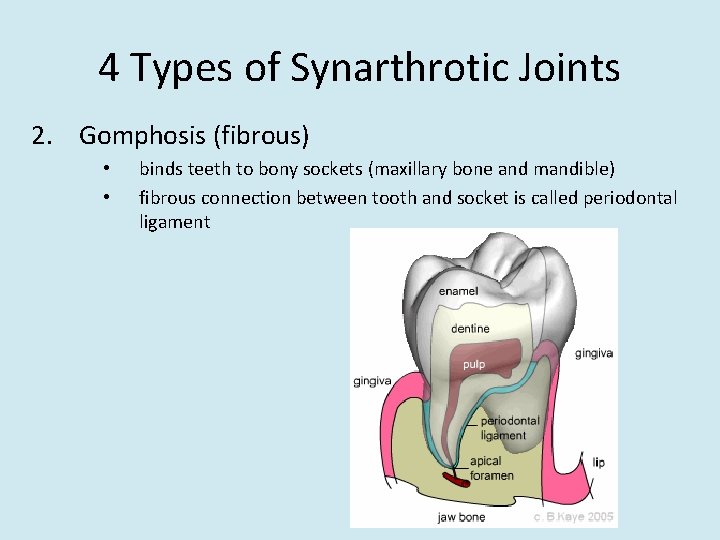 4 Types of Synarthrotic Joints 2. Gomphosis (fibrous) • • binds teeth to bony