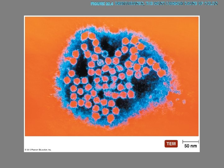 FIGURE 22. 4 RHINOVIRUSES, THE MOST COMMON CAUSE OF COLDS 
