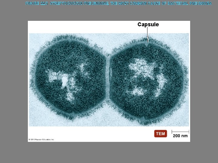 FIGURE 22. 5 STREPTOCOCCUS PNEUMONIAE, THE MOST COMMON CAUSE OF BACTERIAL PNEUMONIA Capsule 