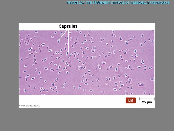 FIGURE 22. 7 THE PROMINENT CAPSULE OF KLEBSIELLA PNEUMONIAE Capsules 