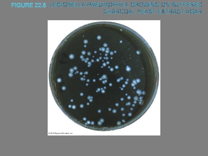 LEGIONELLA PNEUMOPHILA GROWING ON BUFFERED CHARCOAL YEAST EXTRACT AGAR 