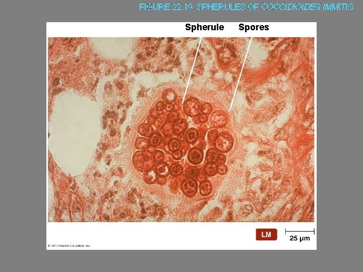 FIGURE 22. 19 SPHERULES OF COCCIDIOIDES IMMITIS Spherule Spores 