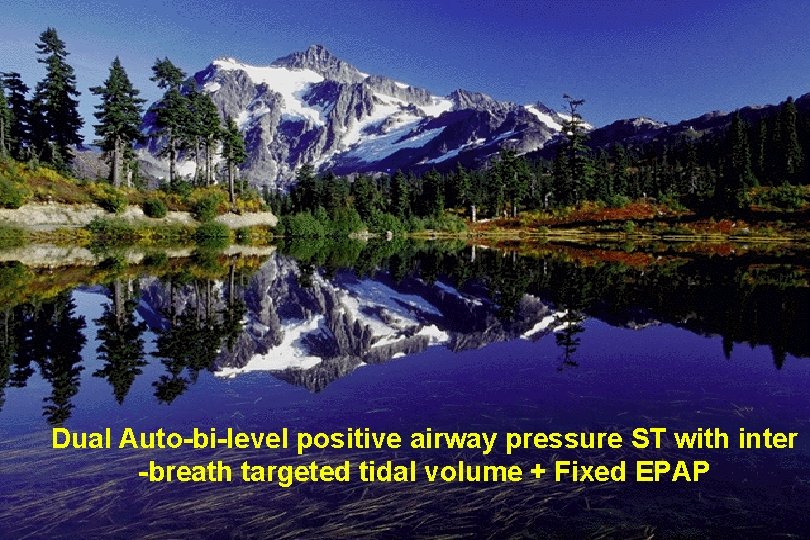 Dual Auto-bi-level positive airway pressure ST with inter -breath targeted tidal volume + Fixed