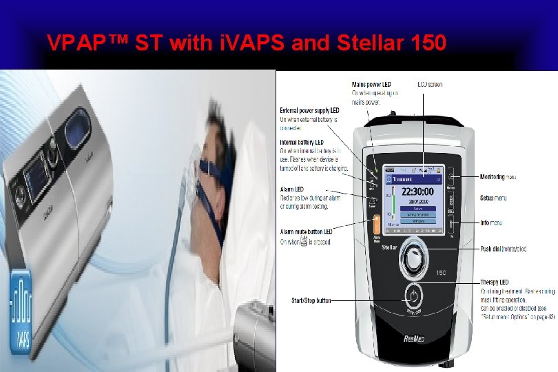 VPAP™ ST with i. VAPS and Stellar 150 