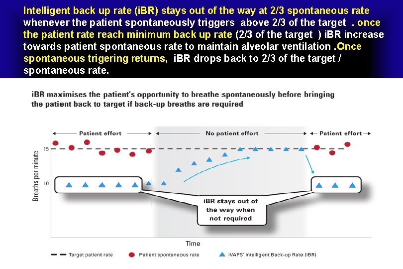 Intelligent back up rate (i. BR) stays out of the way at 2/3 spontaneous