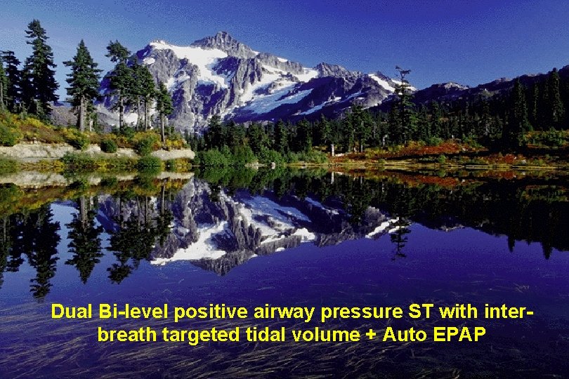 Dual Bi-level positive airway pressure ST with interbreath targeted tidal volume + Auto EPAP
