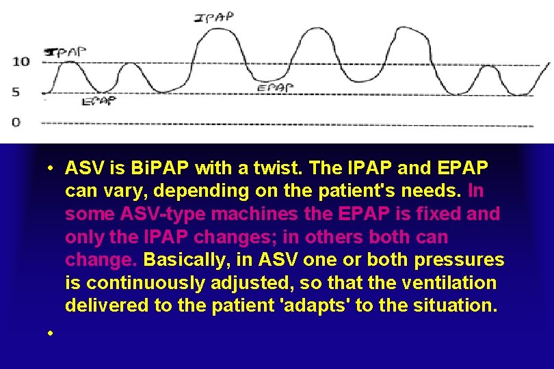  • ASV is Bi. PAP with a twist. The IPAP and EPAP can