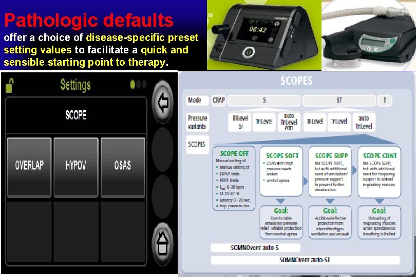 Pathologic defaults offer a choice of disease-specific preset setting values to facilitate a quick