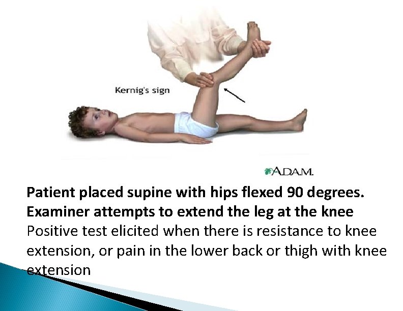 Patient placed supine with hips flexed 90 degrees. Examiner attempts to extend the leg