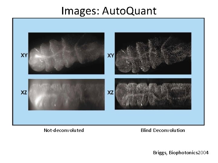 Images: Auto. Quant Not-deconvoluted Blind Deconvolution Briggs, Biophotonics 2004 