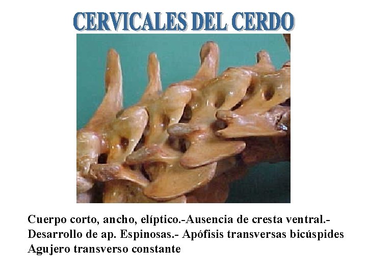 Cuerpo corto, ancho, elíptico. -Ausencia de cresta ventral. Desarrollo de ap. Espinosas. - Apófisis