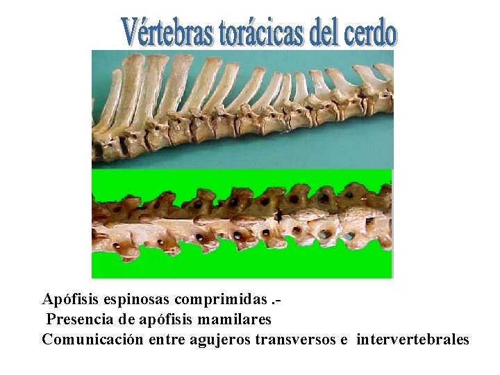 Apófisis espinosas comprimidas. Presencia de apófisis mamilares Comunicación entre agujeros transversos e intervertebrales 