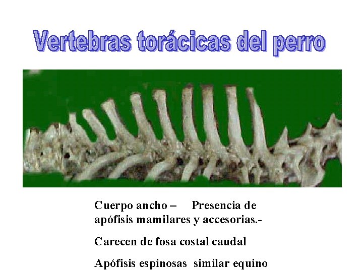 Cuerpo ancho – Presencia de apófisis mamilares y accesorias. Carecen de fosa costal caudal