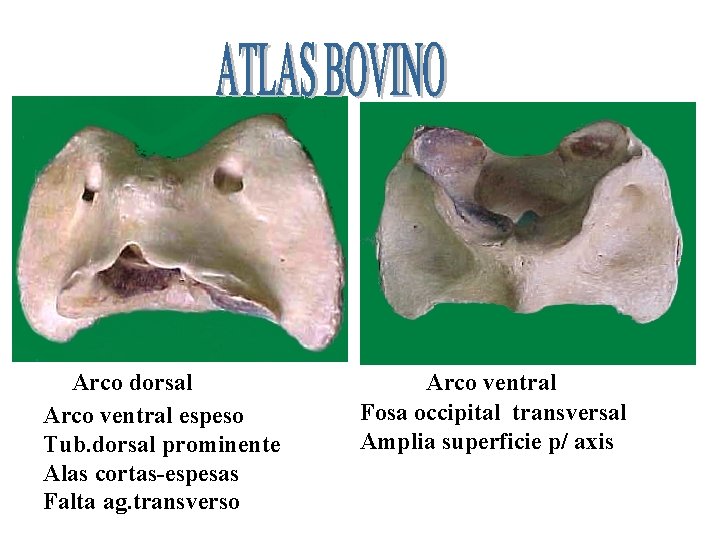 Arco dorsal Arco ventral espeso Tub. dorsal prominente Alas cortas-espesas Falta ag. transverso Arco