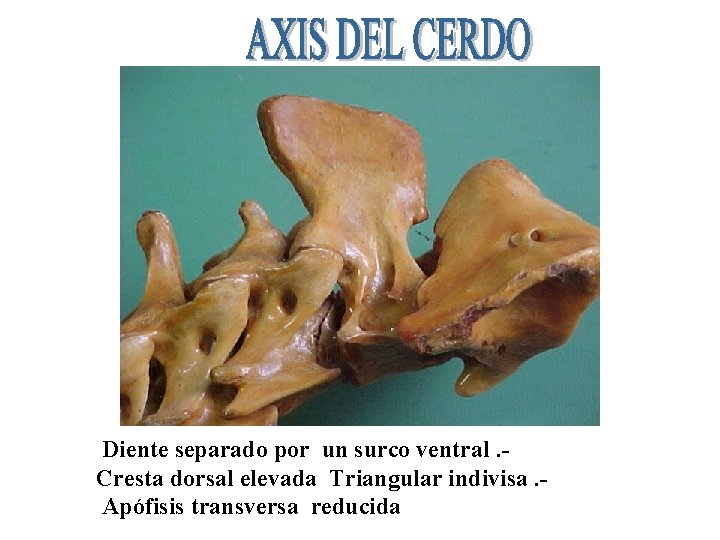 Diente separado por un surco ventral. Cresta dorsal elevada Triangular indivisa. Apófisis transversa reducida