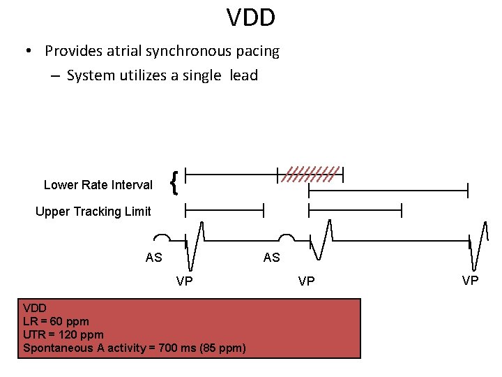 VDD • Provides atrial synchronous pacing – System utilizes a single lead Lower Rate