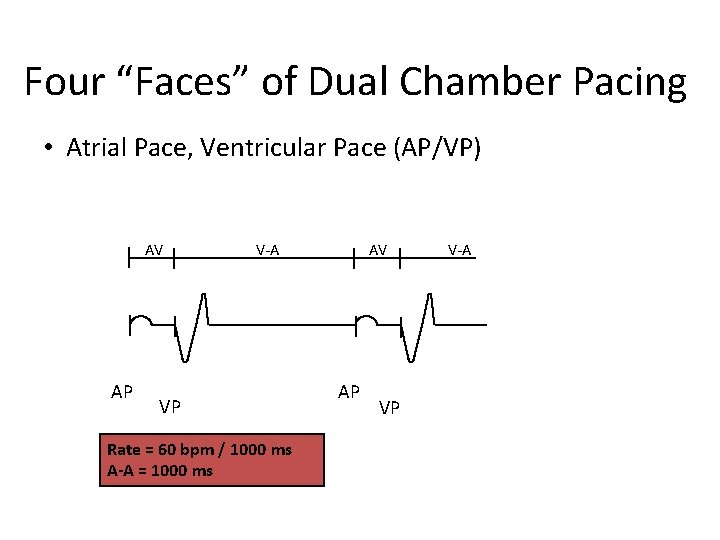 Four “Faces” of Dual Chamber Pacing • Atrial Pace, Ventricular Pace (AP/VP) AV AP