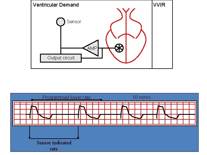 Ventricular Demand VVIR Sensor AMP Output circuit Programmed lower rate Sensor indicated rate 50