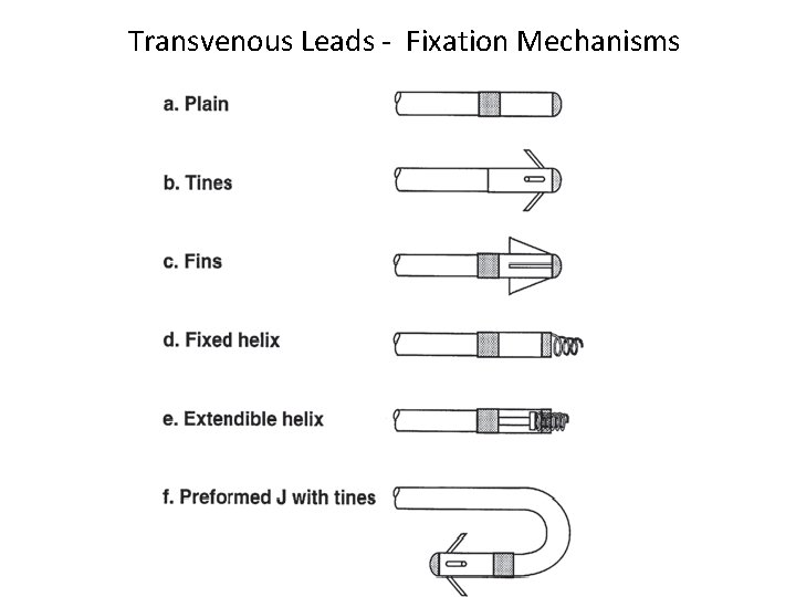 Transvenous Leads - Fixation Mechanisms 