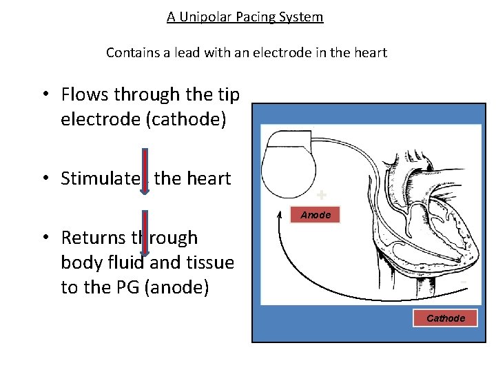A Unipolar Pacing System Contains a lead with an electrode in the heart •