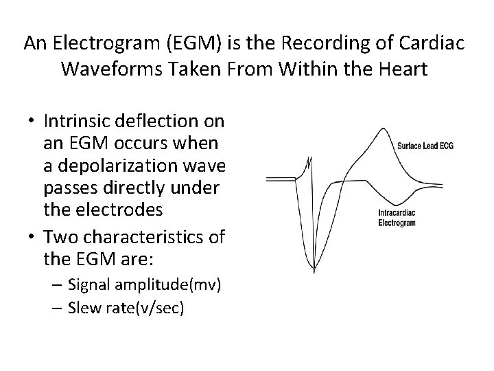 An Electrogram (EGM) is the Recording of Cardiac Waveforms Taken From Within the Heart