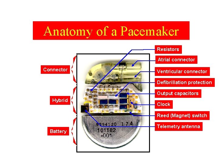Anatomy of a Pacemaker Resistors Atrial connector Connector Ventricular connector Defibrillation protection Output capacitors
