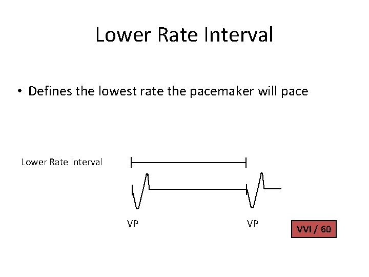 Lower Rate Interval • Defines the lowest rate the pacemaker will pace Lower Rate