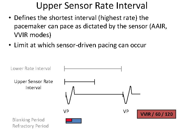 Upper Sensor Rate Interval • Defines the shortest interval (highest rate) the pacemaker can