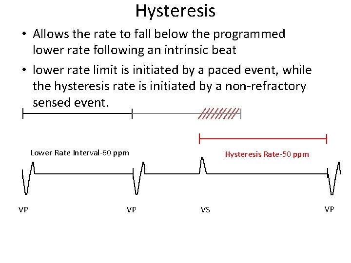 Hysteresis • Allows the rate to fall below the programmed lower rate following an