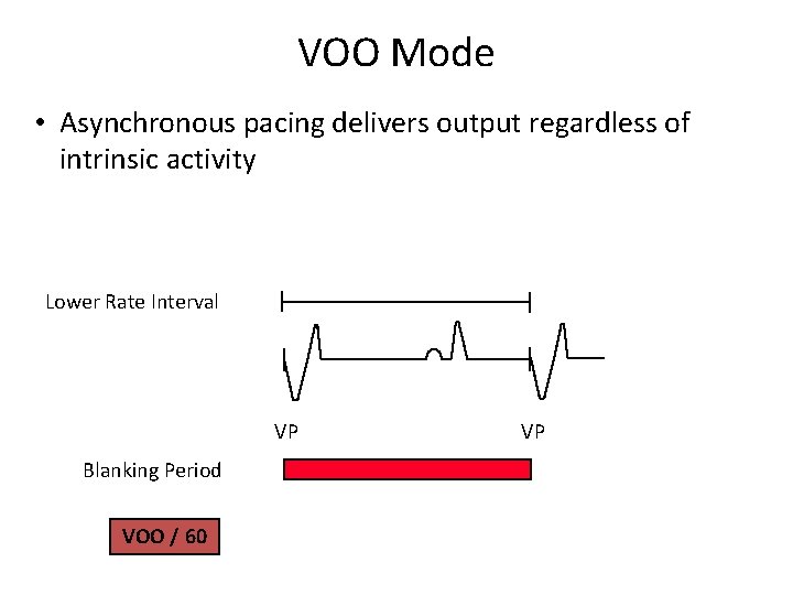 VOO Mode • Asynchronous pacing delivers output regardless of intrinsic activity Lower Rate Interval