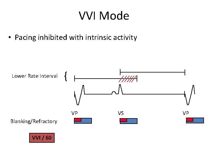 VVI Mode • Pacing inhibited with intrinsic activity Lower Rate Interval { VP Blanking/Refractory