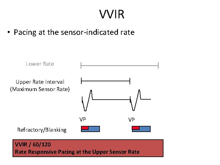 VVIR • Pacing at the sensor-indicated rate Lower Rate Upper Rate Interval (Maximum Sensor