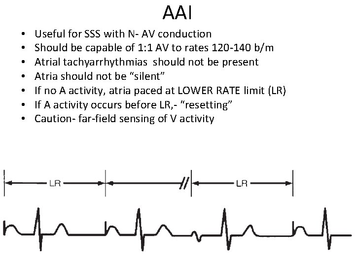 AAI • • Useful for SSS with N- AV conduction Should be capable of