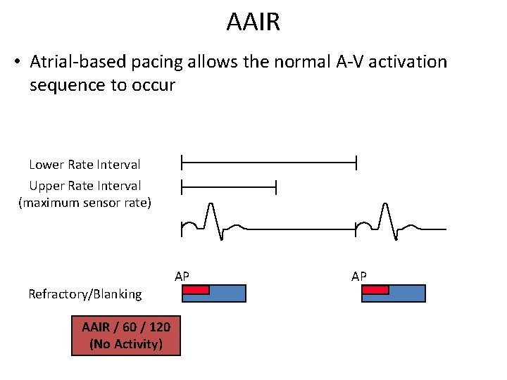 AAIR • Atrial-based pacing allows the normal A-V activation sequence to occur Lower Rate