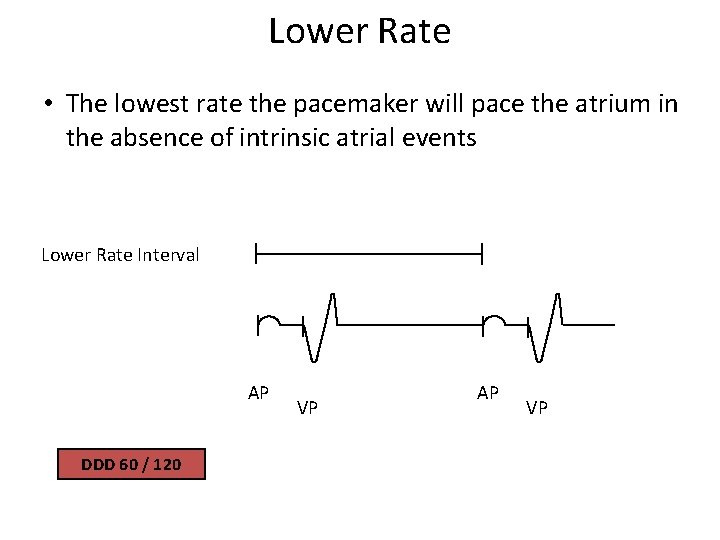 Lower Rate • The lowest rate the pacemaker will pace the atrium in the