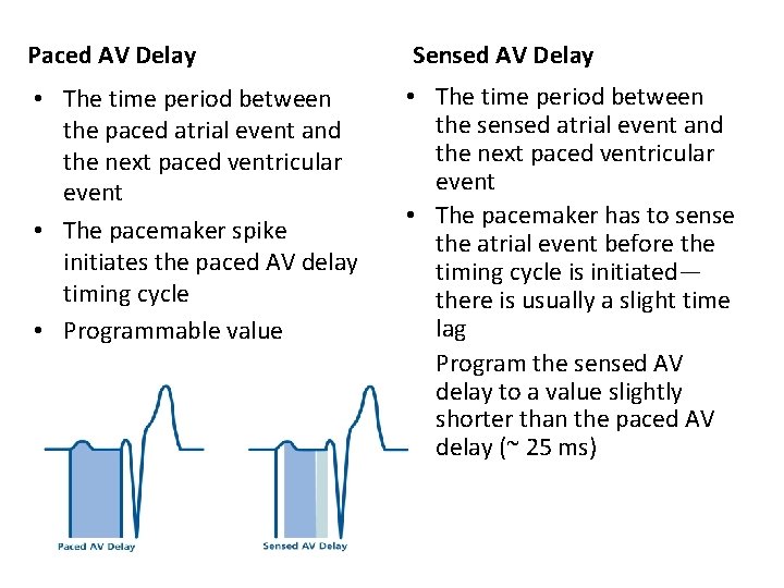 Paced AV Delay Sensed AV Delay • The time period between the paced atrial