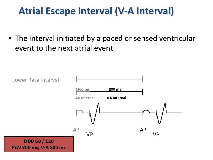 Atrial Escape Interval (V-A Interval) • The interval initiated by a paced or sensed