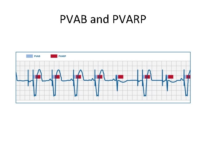 PVAB and PVARP 