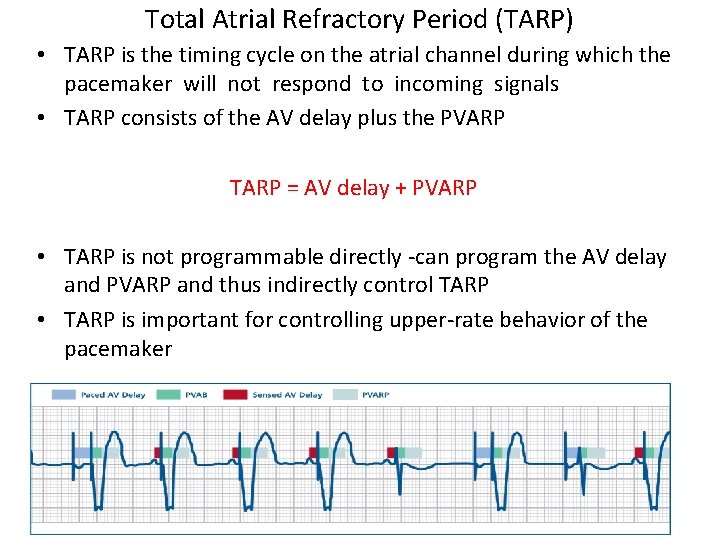 Total Atrial Refractory Period (TARP) • TARP is the timing cycle on the atrial