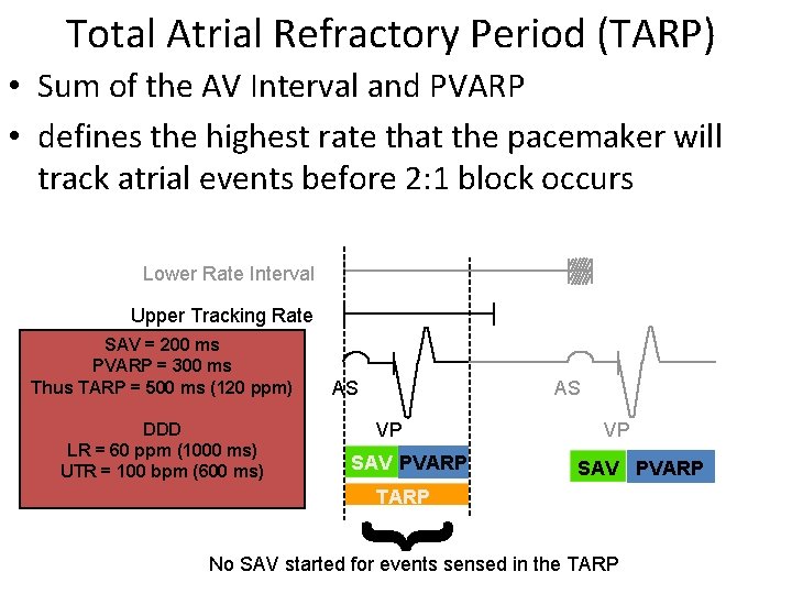 Total Atrial Refractory Period (TARP) • Sum of the AV Interval and PVARP •