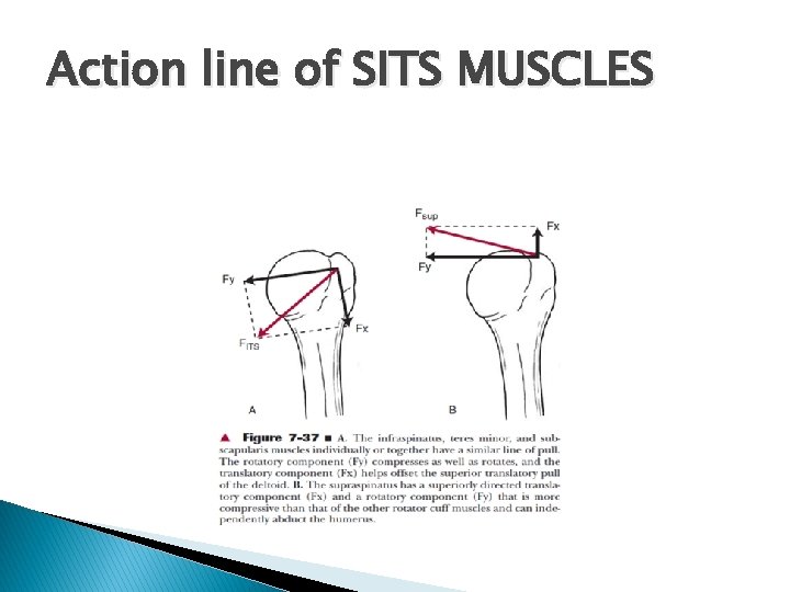 Action line of SITS MUSCLES 
