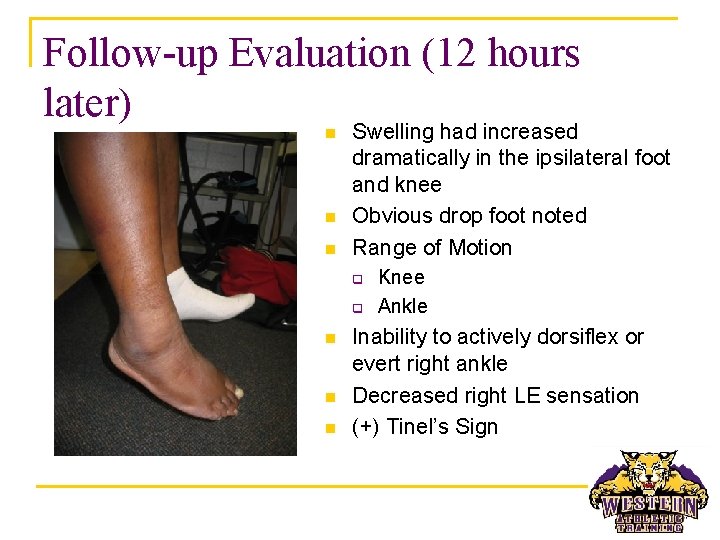 Follow-up Evaluation (12 hours later) n n n Swelling had increased dramatically in the