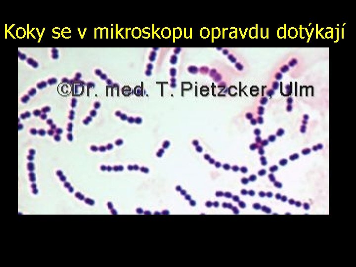 Koky se v mikroskopu opravdu dotýkají 