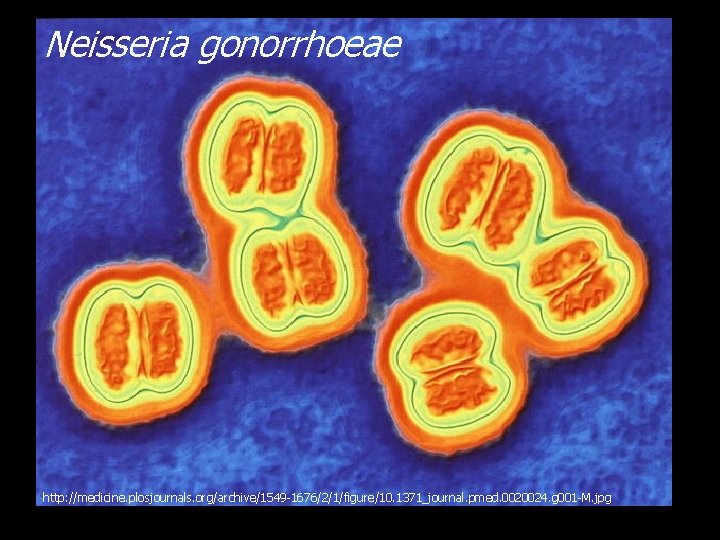 Neisseria gonorrhoeae http: //medicine. plosjournals. org/archive/1549 -1676/2/1/figure/10. 1371_journal. pmed. 0020024. g 001 -M. jpg