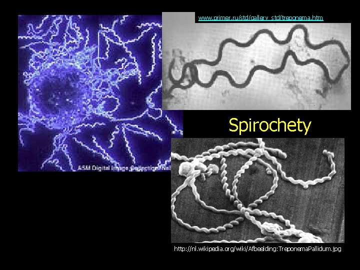 www. primer. ru/std/gallery_std/treponema. htm Spirochety http: //nl. wikipedia. org/wiki/Afbeelding: Treponema. Pallidum. jpg 