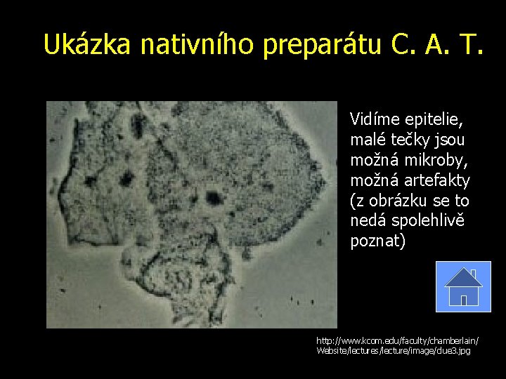 Ukázka nativního preparátu C. A. T. Vidíme epitelie, malé tečky jsou možná mikroby, možná