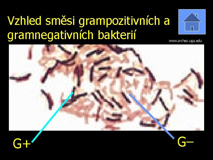 Vzhled směsi grampozitivních a gramnegativních bakterií www. arches. uga. edu G+ G– 