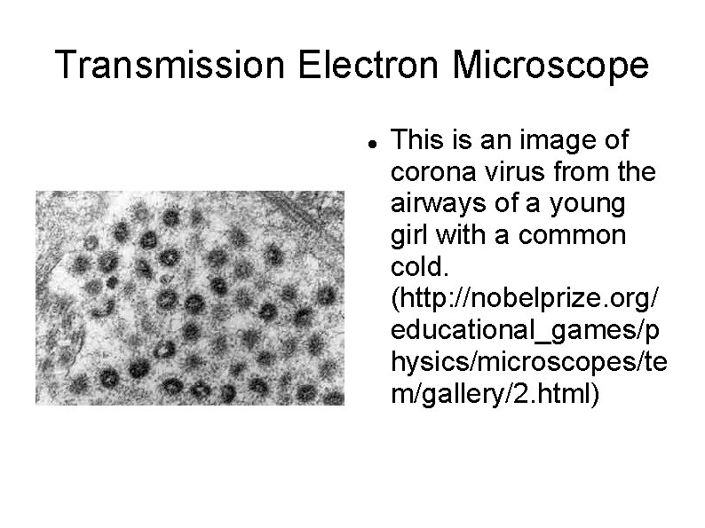 Transmission Electron Microscope This is an image of corona virus from the airways of