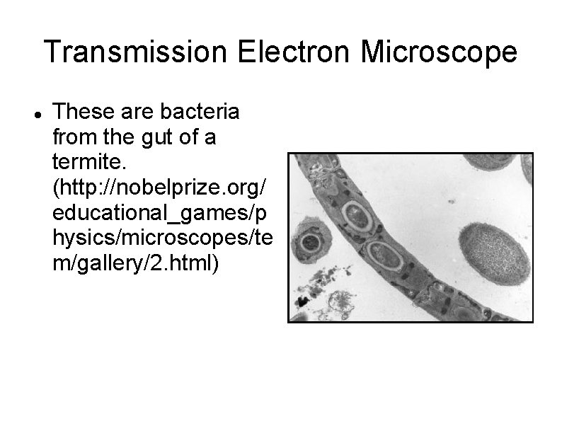 Transmission Electron Microscope These are bacteria from the gut of a termite. (http: //nobelprize.
